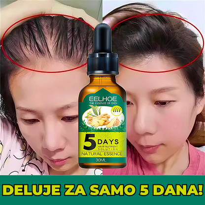 JAPANSKI SERUM ZA RAST KOSE NA BAZI ĐUMBIRA